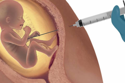 Novas Regras para o Aborto no Brasil: O Que o Projeto de Lei 1904 Pode Significar?